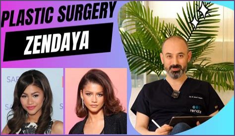 Unveiling The Truth: Zendaya's Plastic Surgery Journey